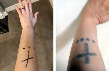 ▲ 윤현경 씨와 윤기태 씨의 팔(왼쪽부터)에 새겨진 문신 모양이 같다.