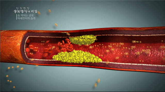 사진 제공 = KBS 1TV '생로병사의 비밀'