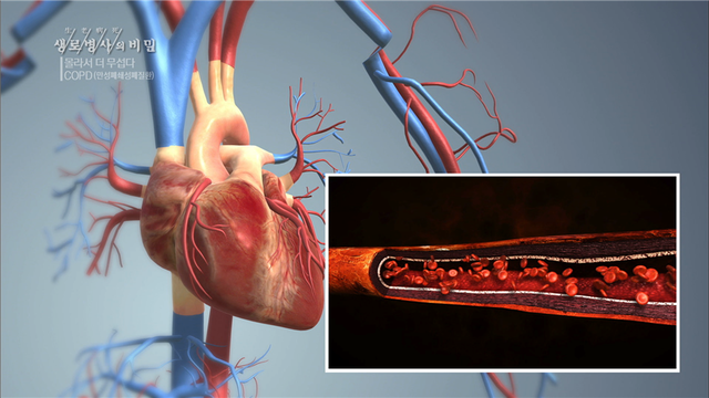 스틸 = KBS 생로병사의 비밀